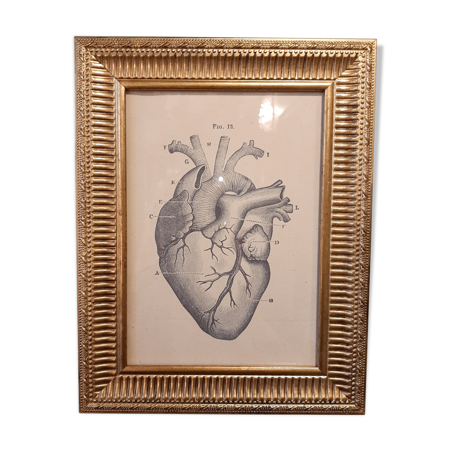 Anatomical heart frame