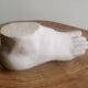 Plaster foot