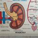 Poster school  excretion & hygiene first aid