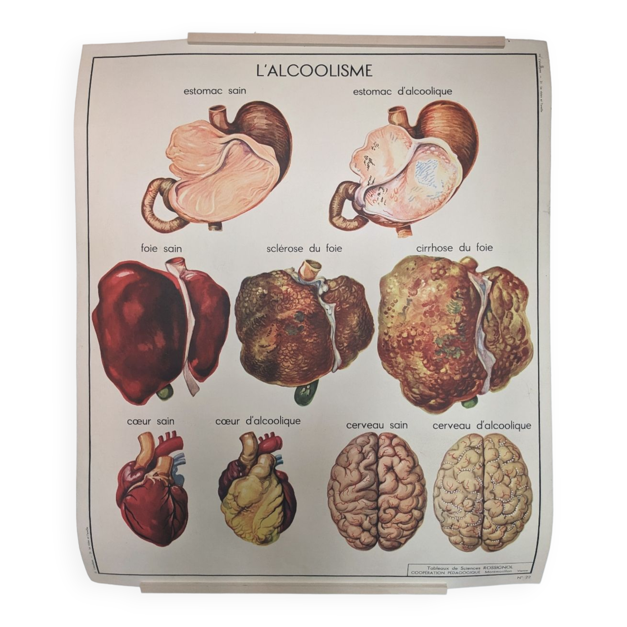 Rossignol alcoholism school poster