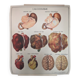 Rossignol alcoholism school poster