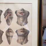 Gravure Cheiloplastic Facial Surgery Anatomy Nicolas Jacob Bourgery