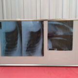 X-ray lightbox