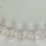 Vintage lampshade in white opaline glass with a transparent serrated edge – Globe