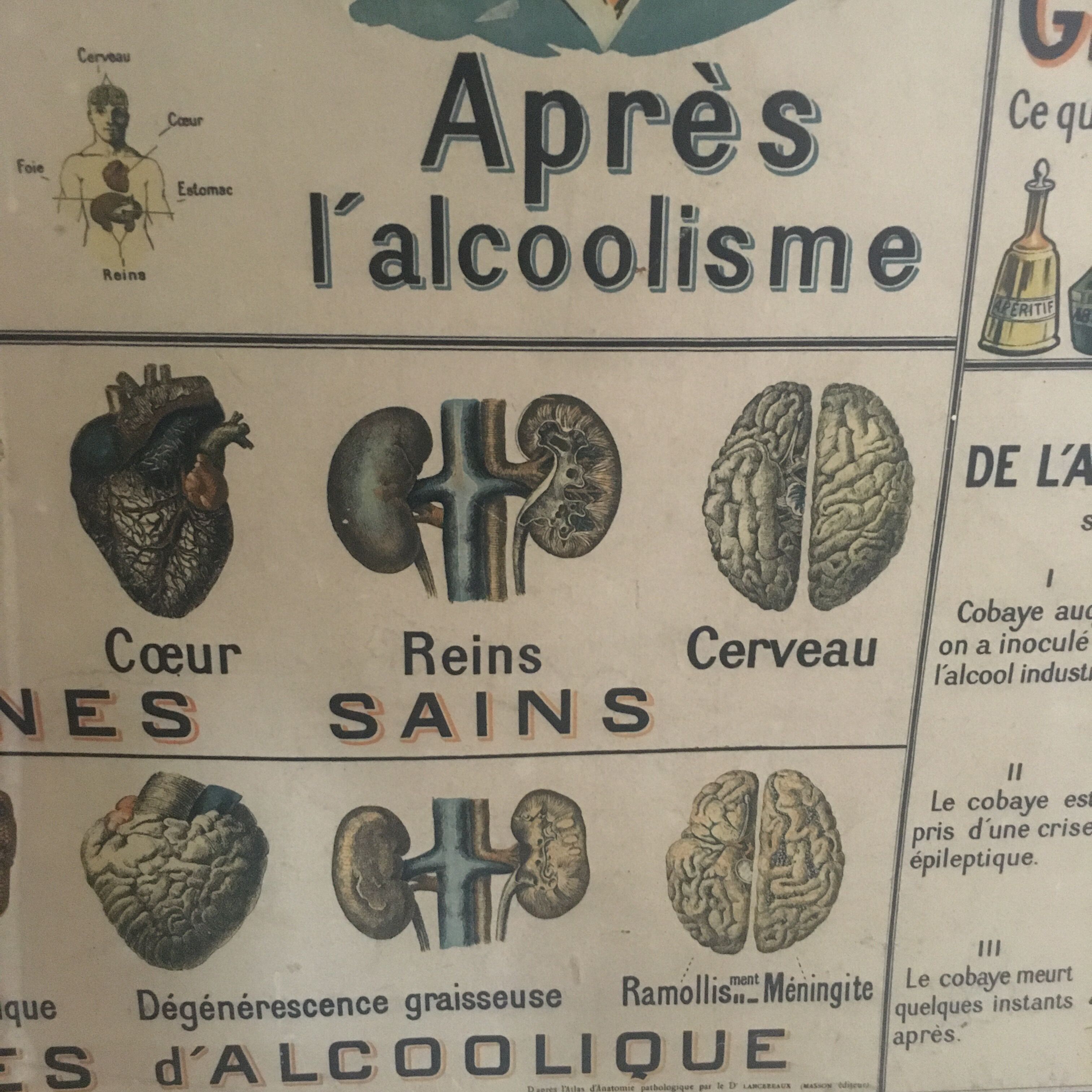 Educational panel "Alcohol is the enemy" 1910