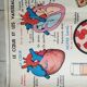 Poster school - heart vessels and duplex absorption