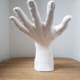 Plaster hand