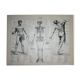 Engraving • Human anatomy, medicine • Original lithograph from 1898
