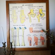 Former School Poster Rossignol of the 50s anatomy medicine bones joints