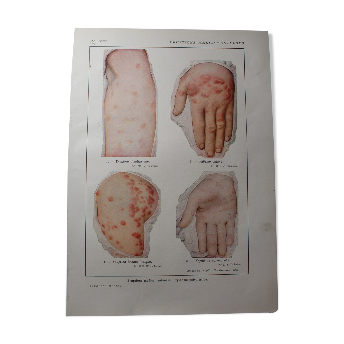 Medical board - anatomy - drug rashes | Selency