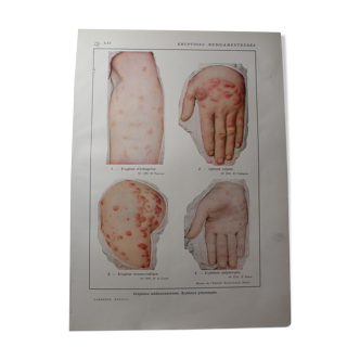 Medical board - anatomy - drug rashes