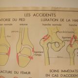 Old school poster Rossignol Bones and joints and accidents 90 cm