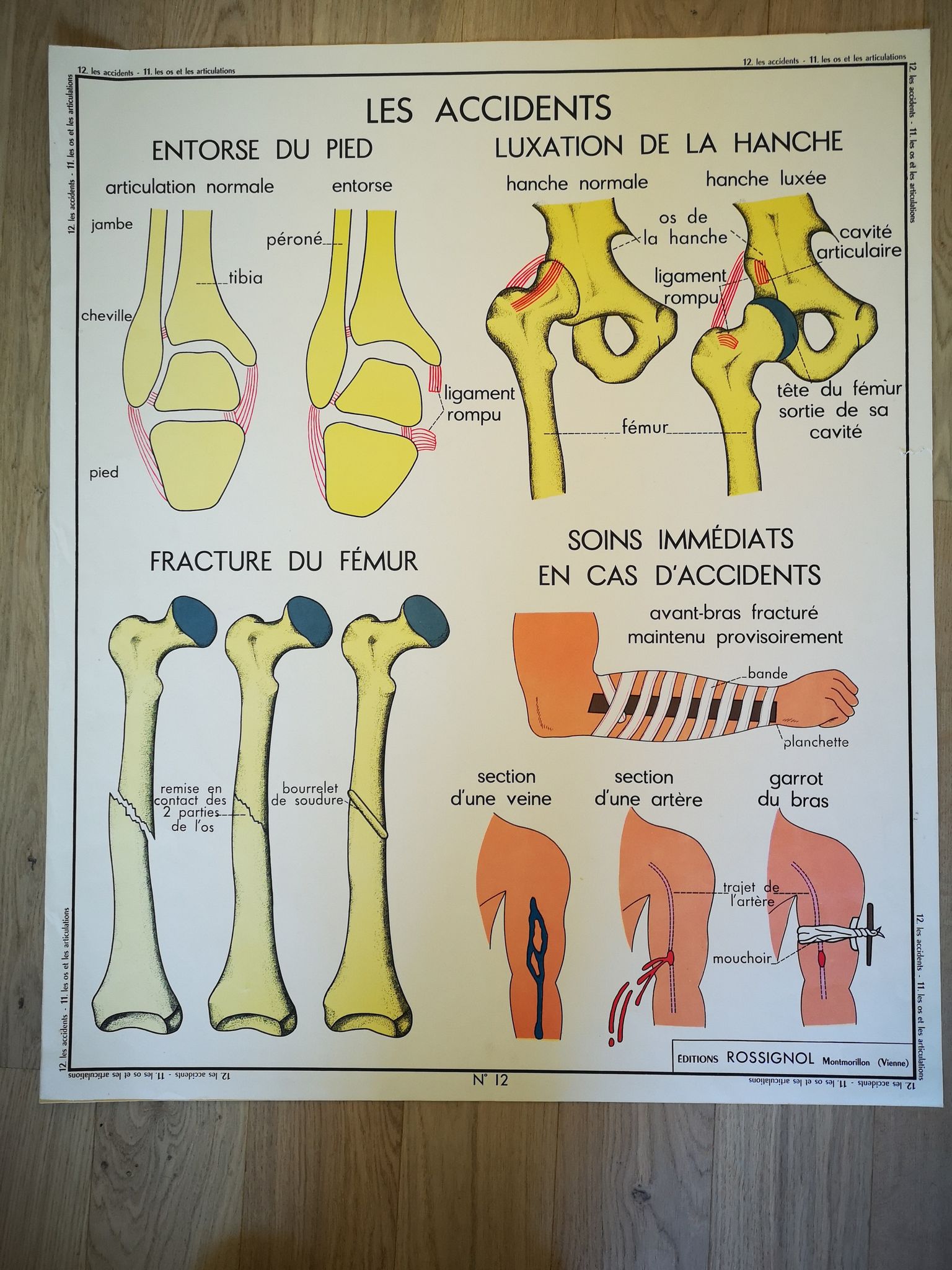 Former School Poster Rossignol of the 50s anatomy medicine bones joints