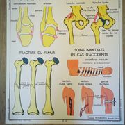 Former School Poster Rossignol of the 50s anatomy medicine bones joints