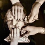 “Schielens Operation (Squint Surgery)” – 1944 Art Photo