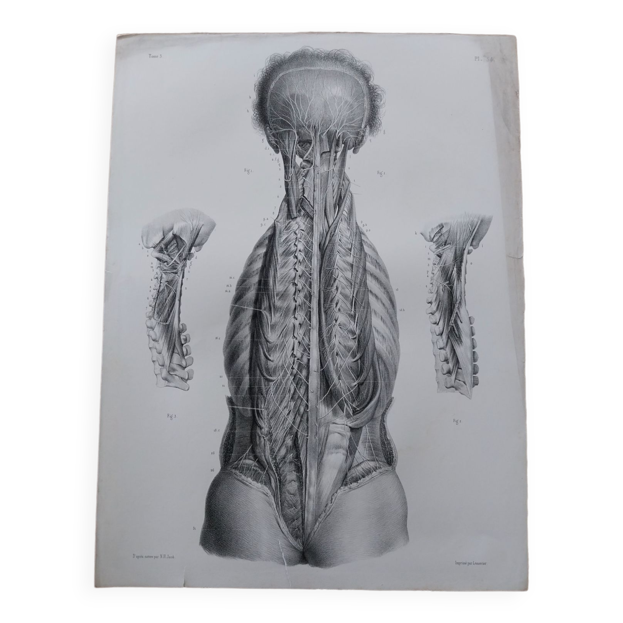Anatomical chart XIXth