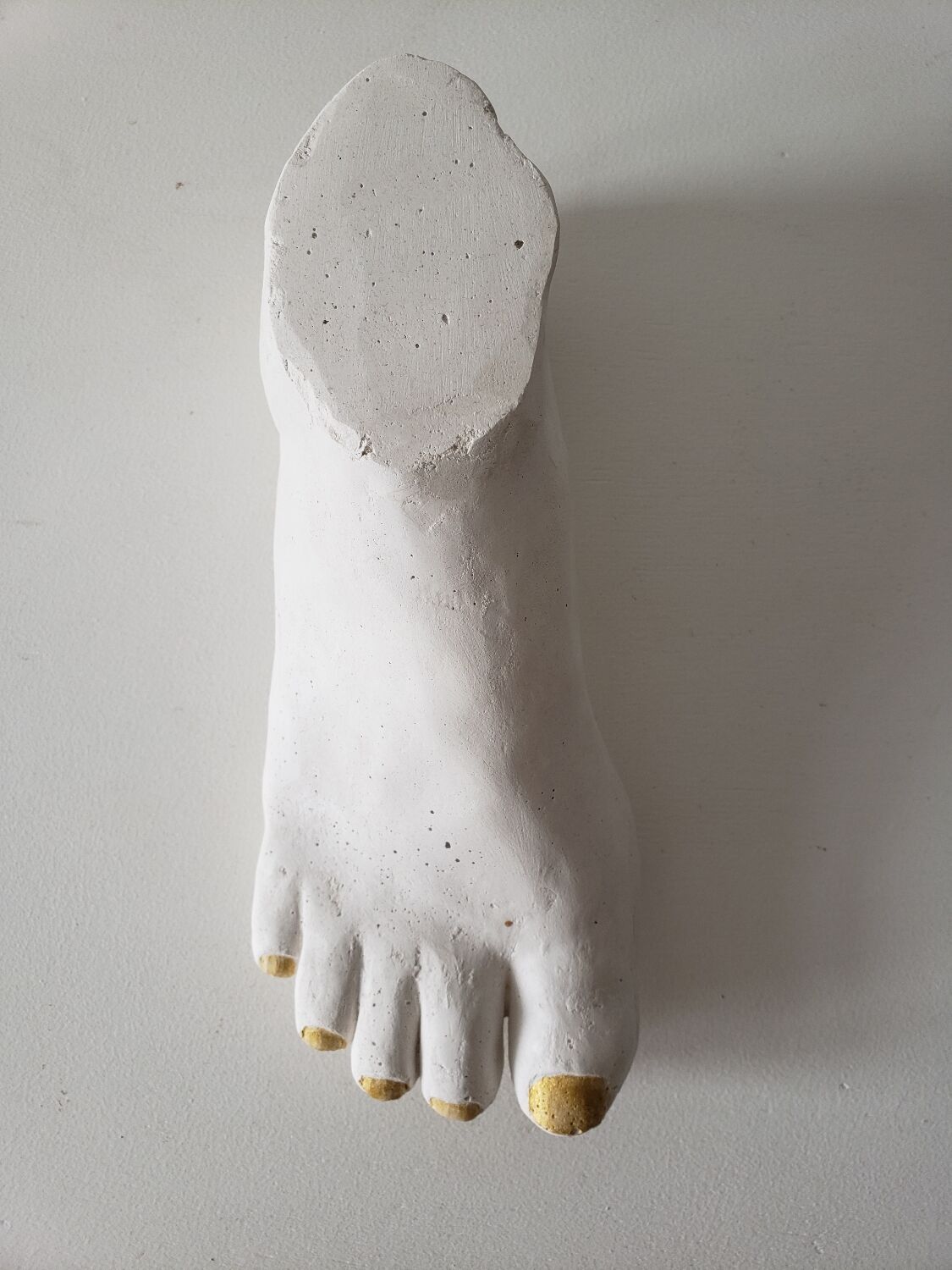 Woman's foot in plaster