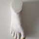 Woman's foot in plaster