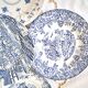 Mismatched antique dinner plates