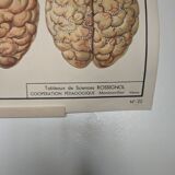 Rossignol alcoholism school poster