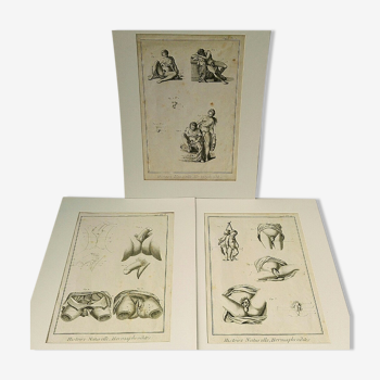 Engravings EIGHTEENth hermaphrodites Diderot cabinet curiosity