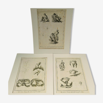 Gravures xviiie hermaphrodites diderot cabinet curiosité