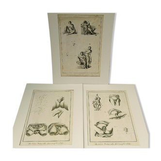 Engravings EIGHTEENth hermaphrodites Diderot cabinet curiosity