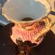 Vase Vallauris 1950 rose noir et jaune