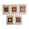 Série de 5 anciennes planches ophtalmologiques lithographiées en couleur de 1924