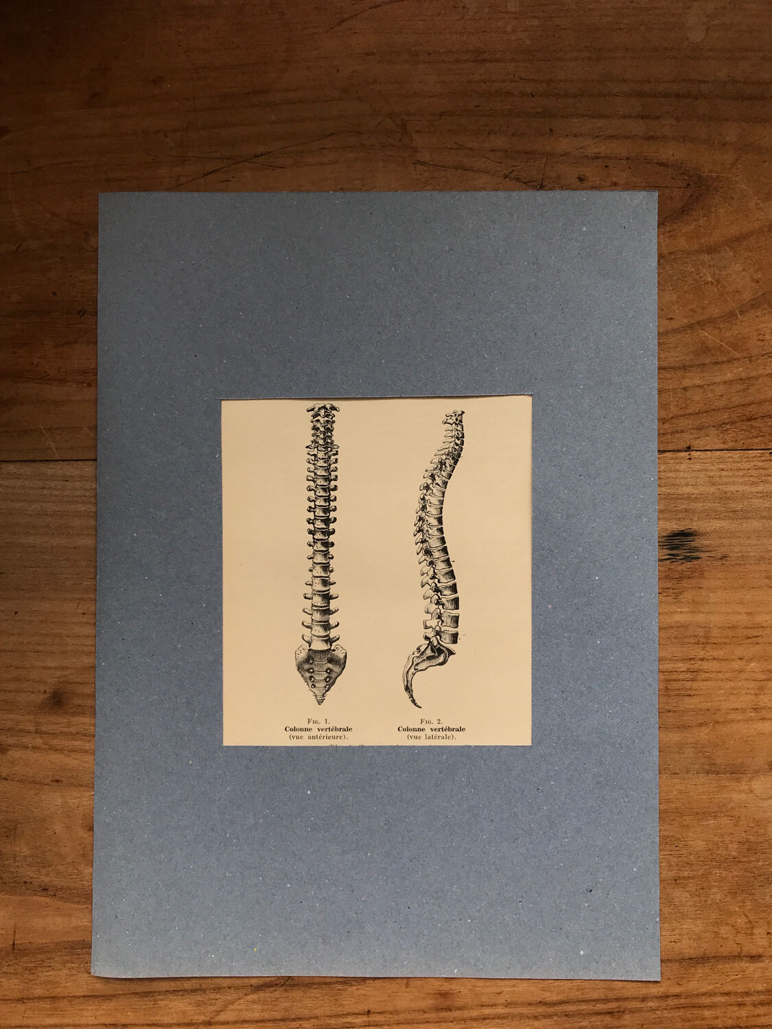 Vintage board medicine