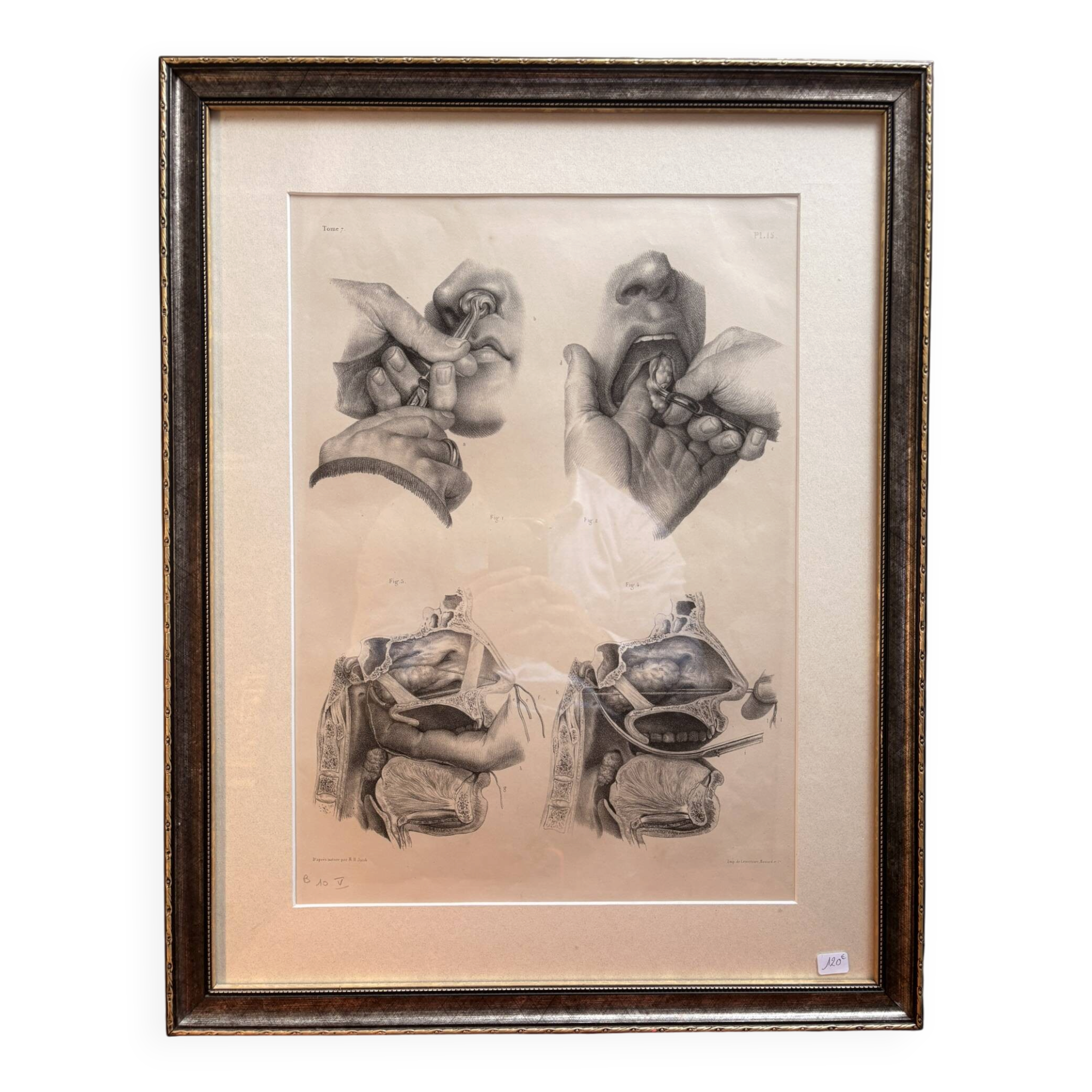 Old Engraving Nose Nasal Cavity NICOLAS HENRI Jacob Bourgery Medical Anatomy