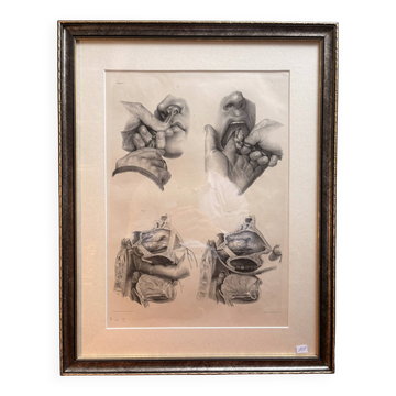 Ancien Gravure Nez Bouche Nasale NICOLAS HENRI Jacob Bourgery Anatomie Médi