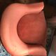Fauteuil crapaud