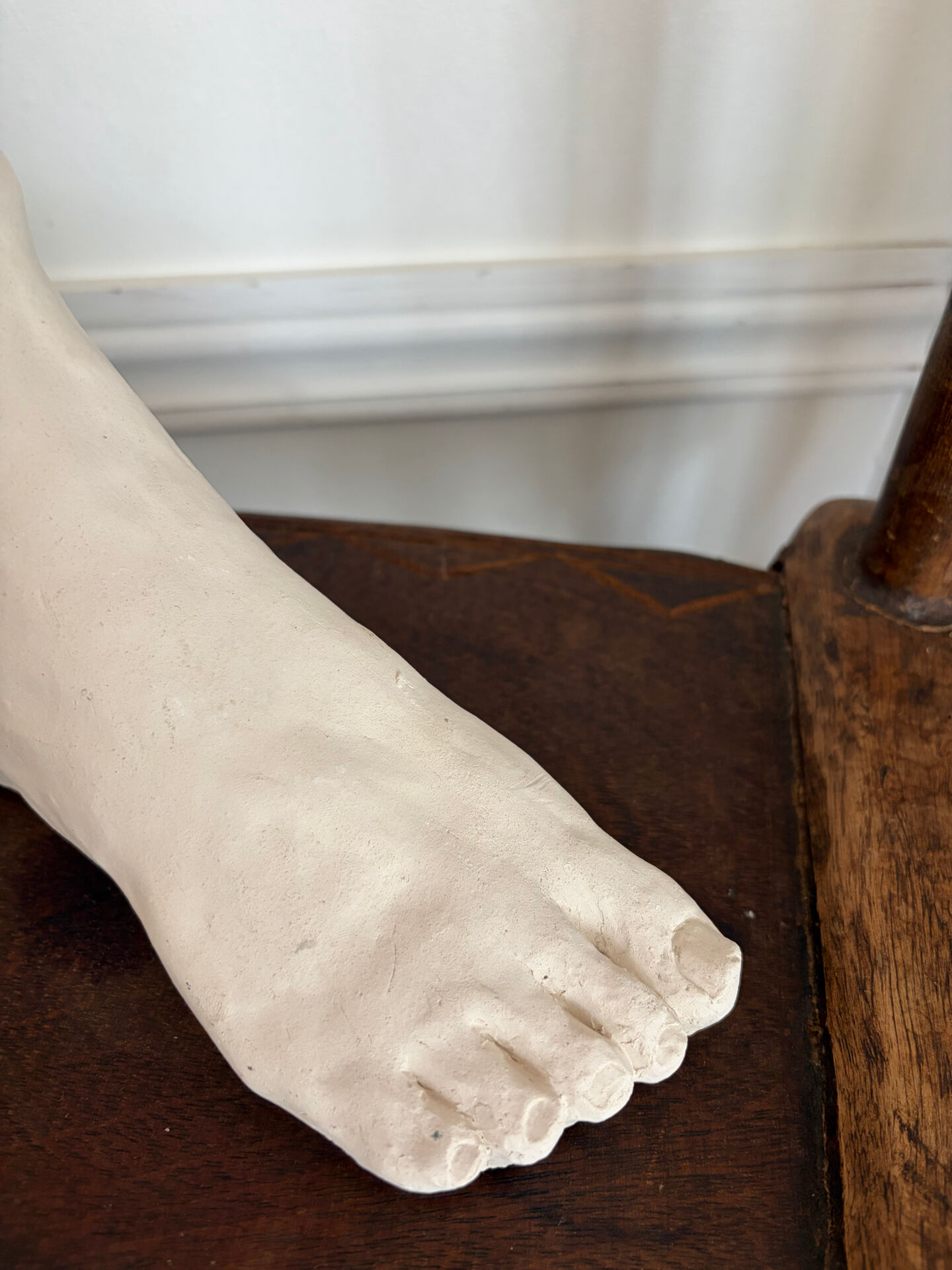 White plaster foot cast