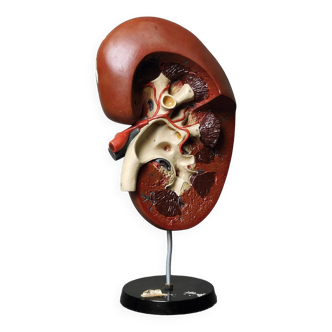 Curiosity Model Anatomy Resin Human Kidney 1970