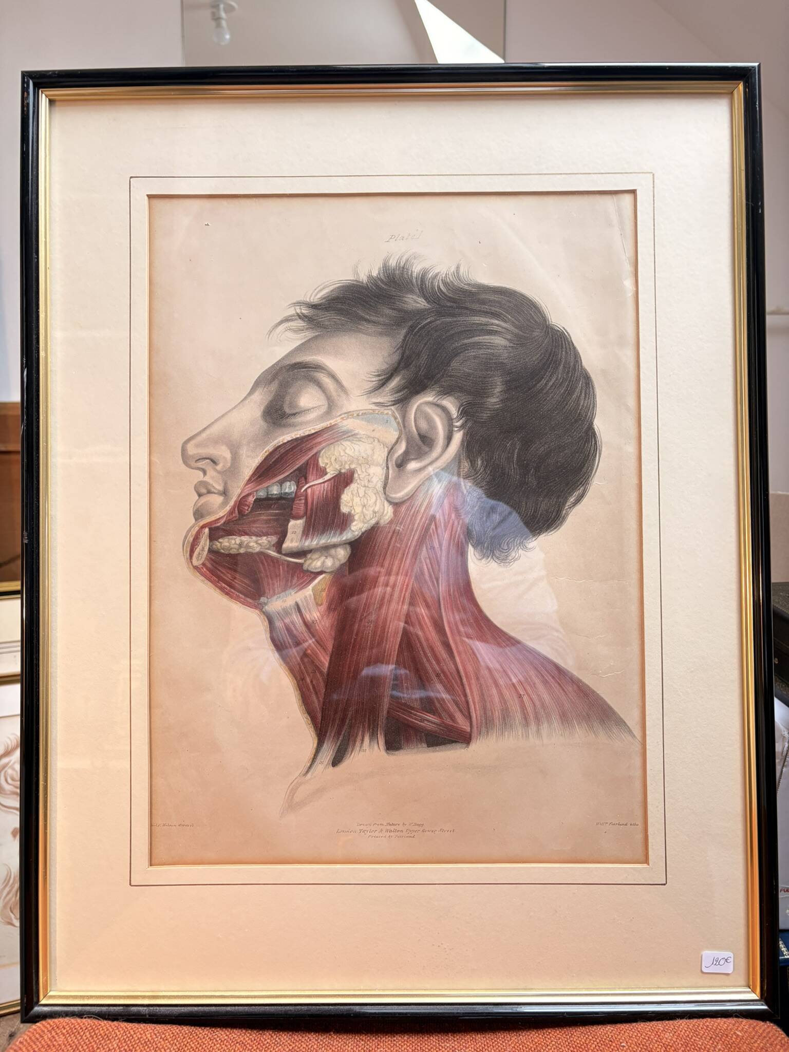 Print Engraving 19th Century The Salivary Gland Head Anatomy William Bagg