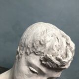 Plaster sculpture "Boy with a severed ear" 1913