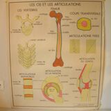 Old school poster Rossignol Bones and joints and accidents 90 cm