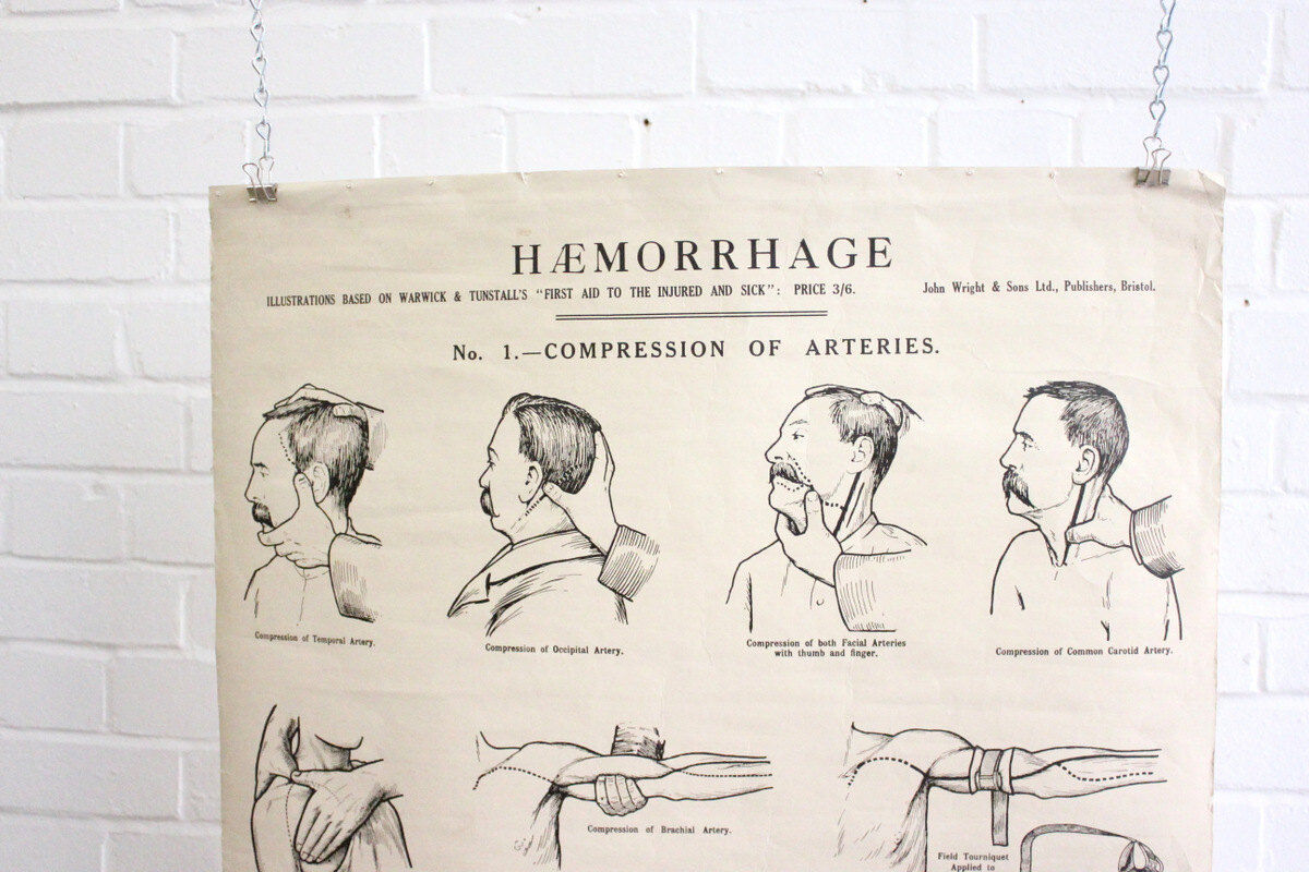 Displays educational anatomical bleeding
