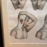 Gravure Plastic Surgery Rhinoplasty NICOLAS Jacob Bourgery Anatomy