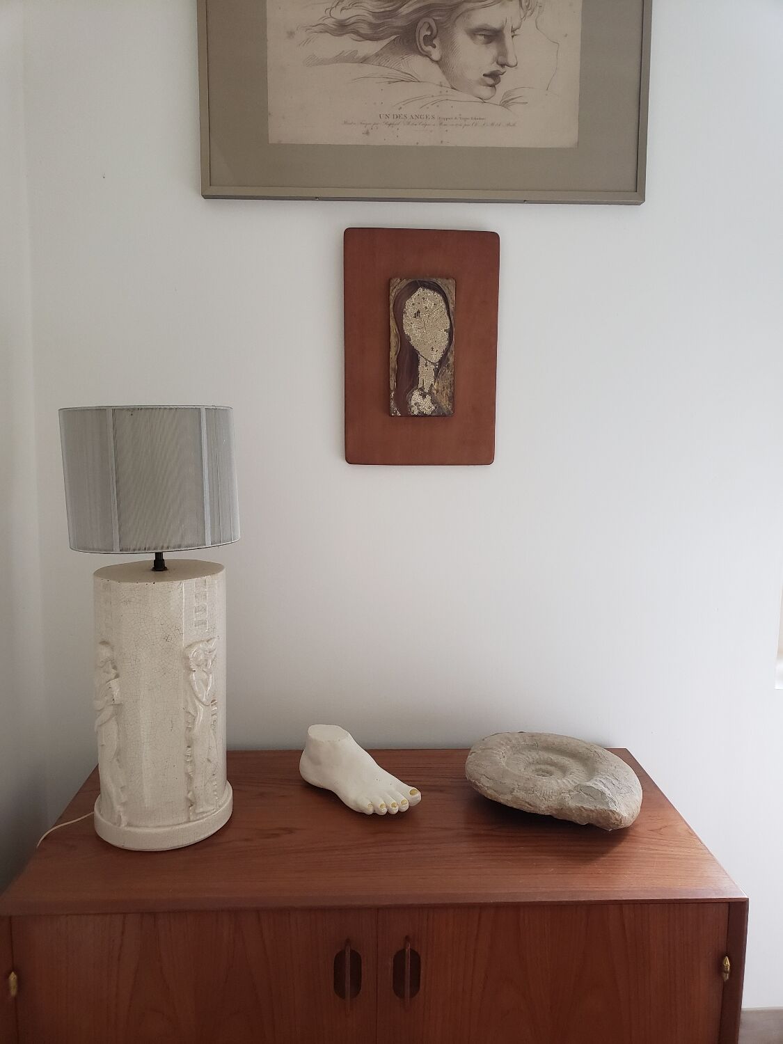 Woman's foot in plaster
