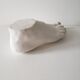Woman's foot in plaster