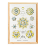Poster about polycystic kidney stones, based on an old lithograph from 1904.