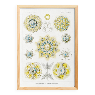 Poster about polycystic kidney stones, based on an old lithograph from 1904.
