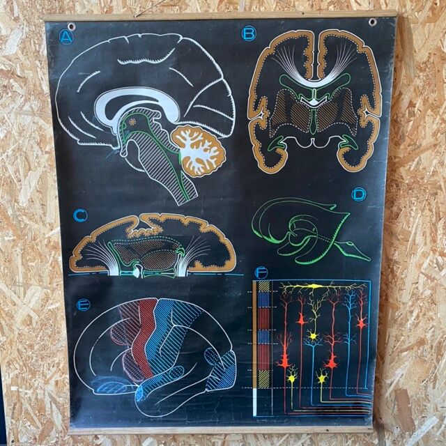 Dr. Auzoux's school poster "The brain"
