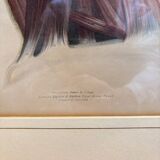 Print Engraving 19th Century The Salivary Gland Head Anatomy William Bagg