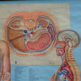 Affiche éducative médicale