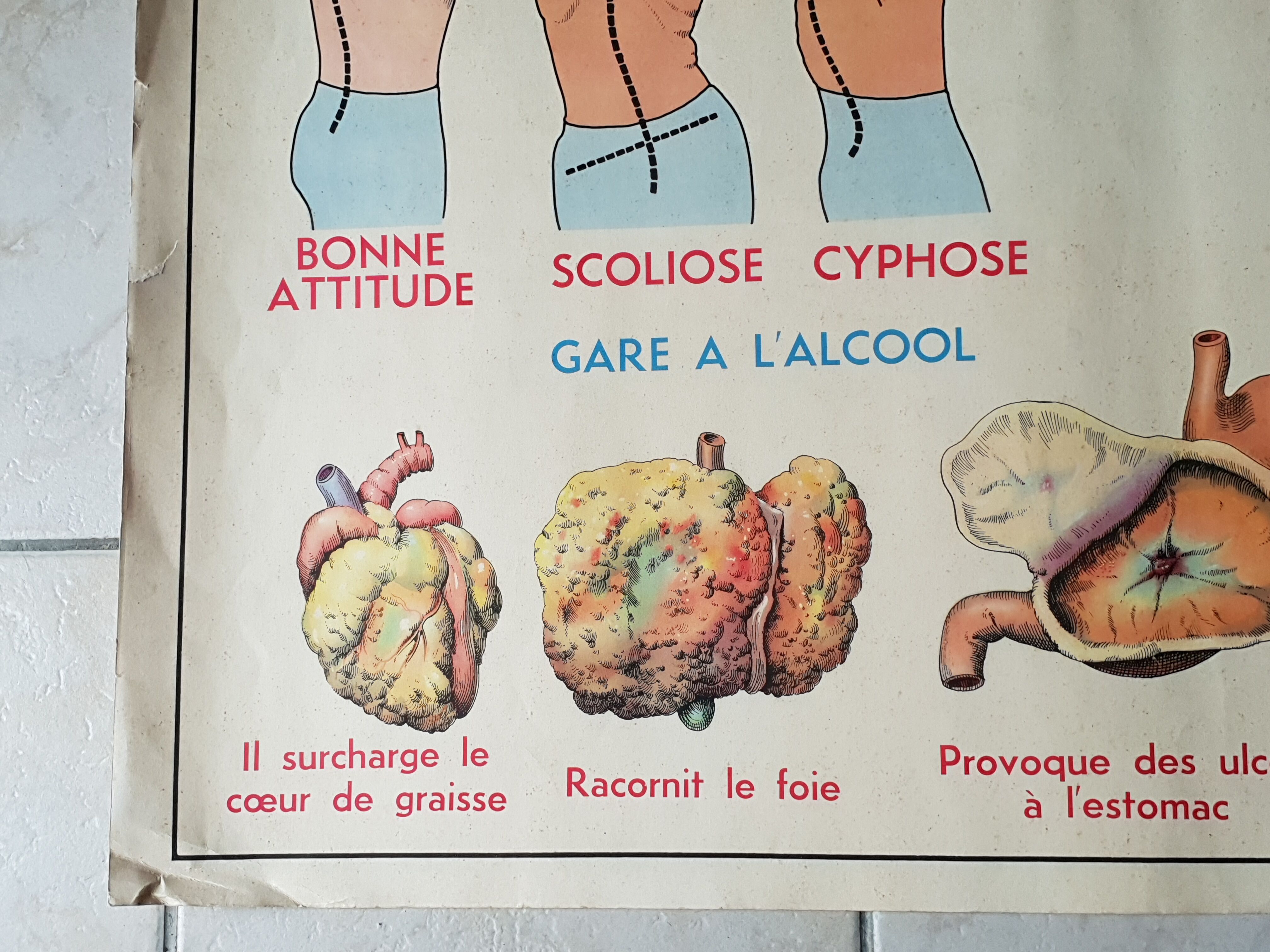 Poster school  excretion & hygiene first aid