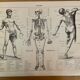 Lot de 3 lithos XXE