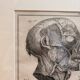 Old Print Engraving 19th Century Framed Anatomy Artery Face Bernard Dixerit